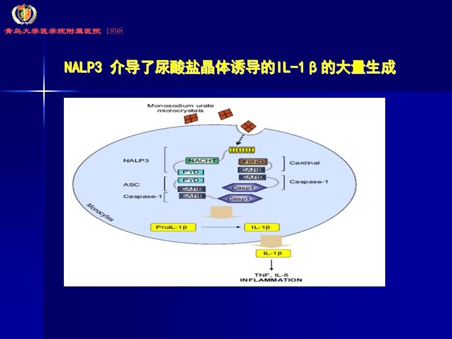 《痛风讲座》PPT课件_第4页