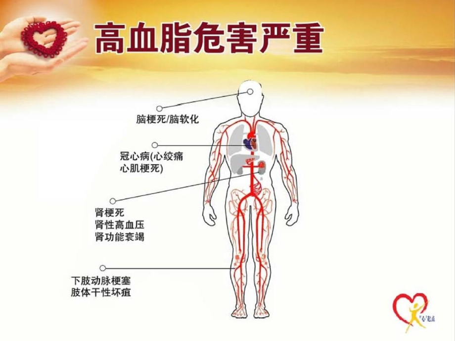 高脂血症健康讲座课件_第4页