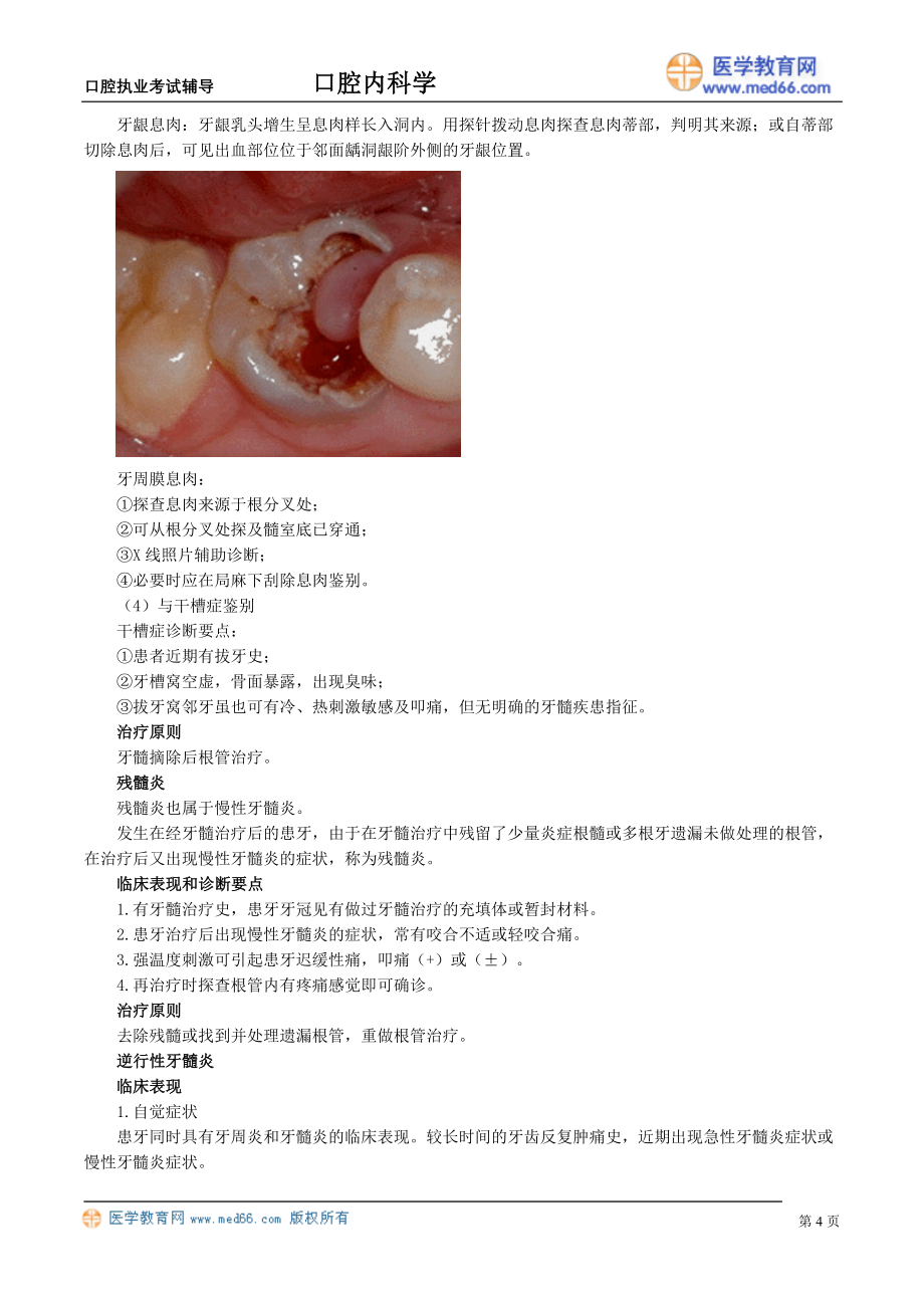 牙体牙髓病学 牙髓炎_第4页