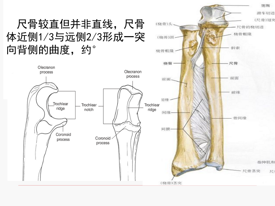 《尺骨骨折和骨间膜》PPT课件_第3页