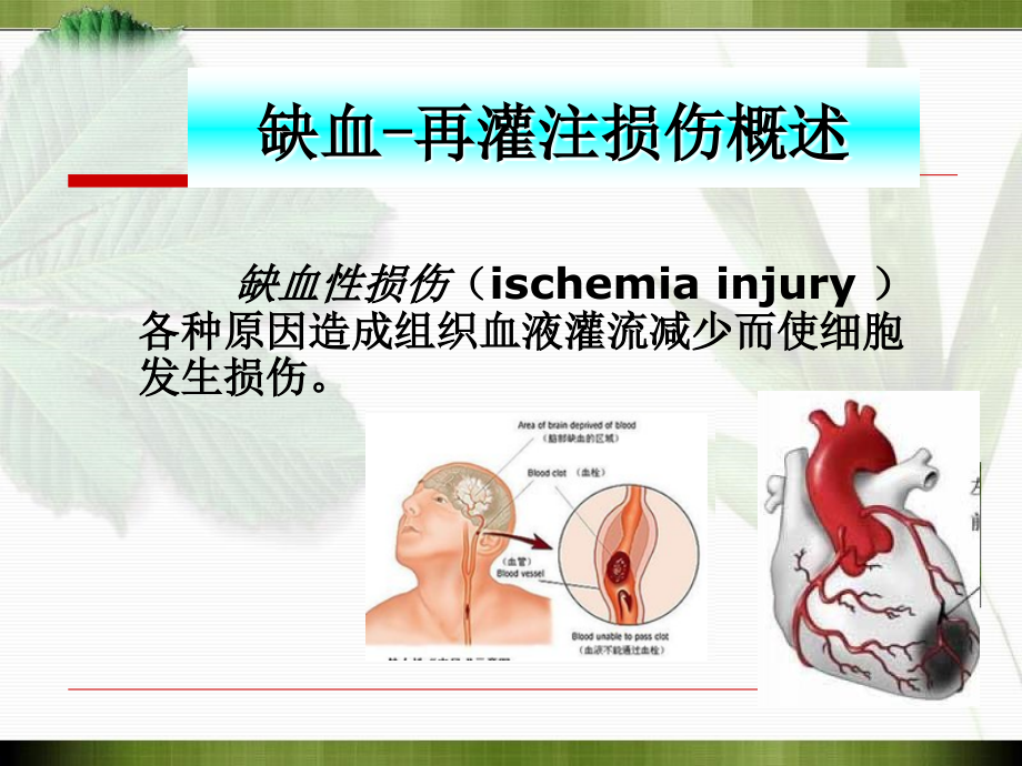 病理生理学课件(石磊)病生缺血再灌注损伤_第4页