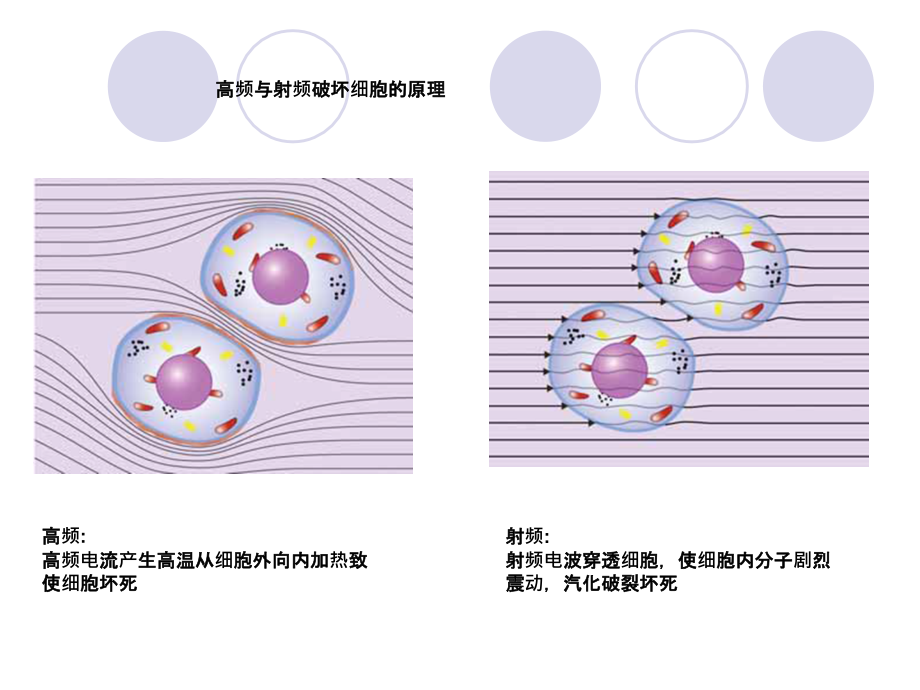 Sutter低温射频刀介绍课件_第3页