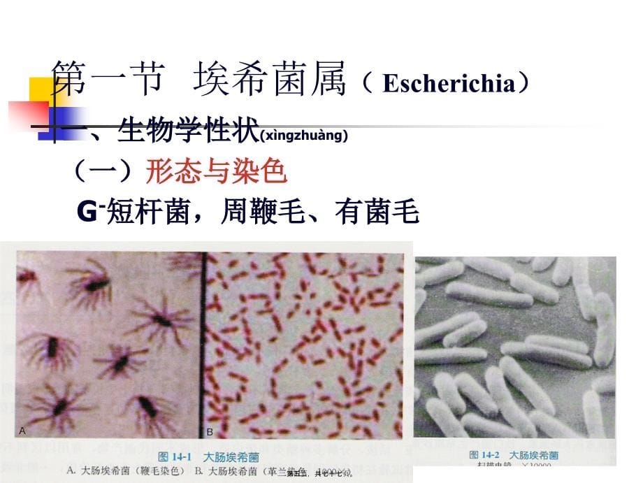 2022年医学专题—第10章--肠杆菌科_第5页