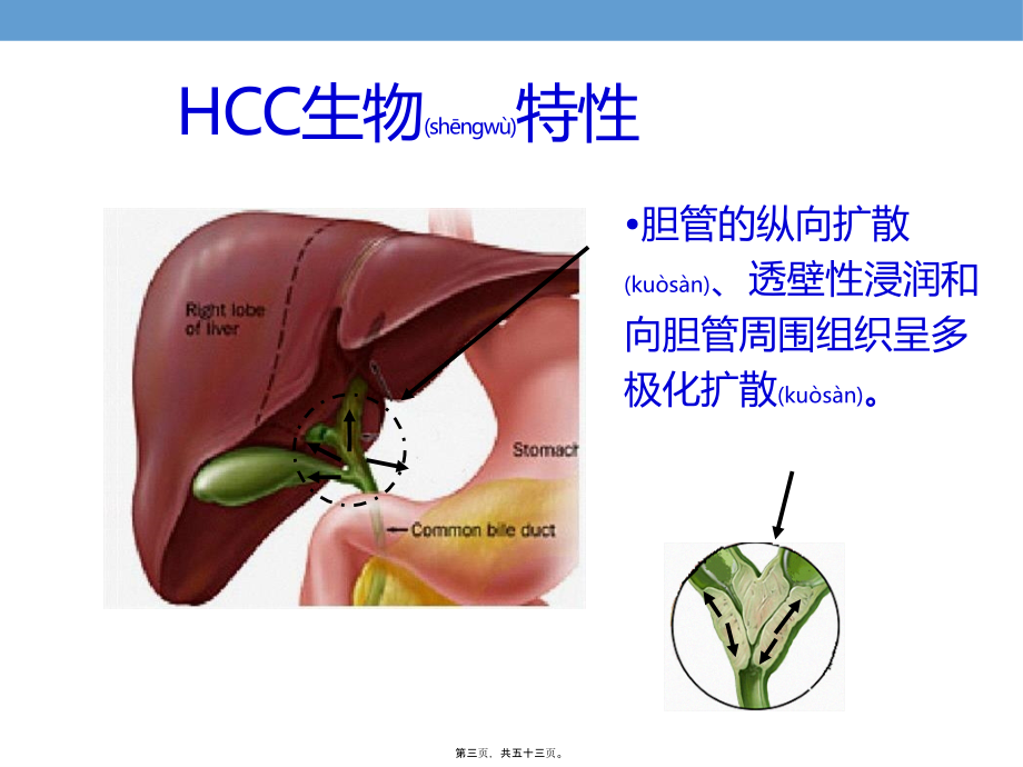 2022年医学专题—肝门胆管癌淋巴结NEW_第3页