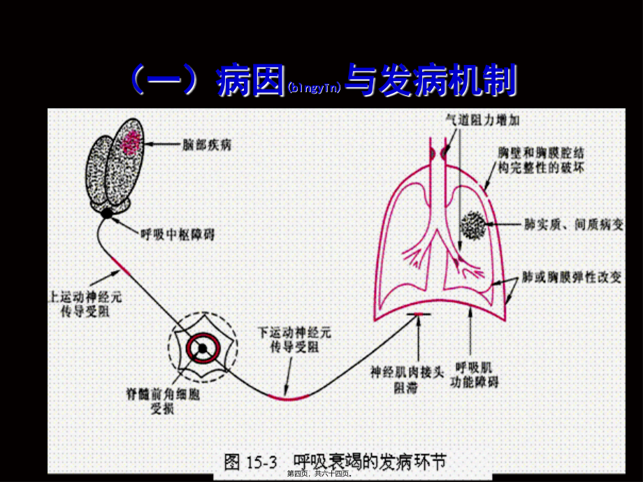 2022年医学专题—第十三节--呼吸衰竭和急性呼吸窘迫综合征_第4页