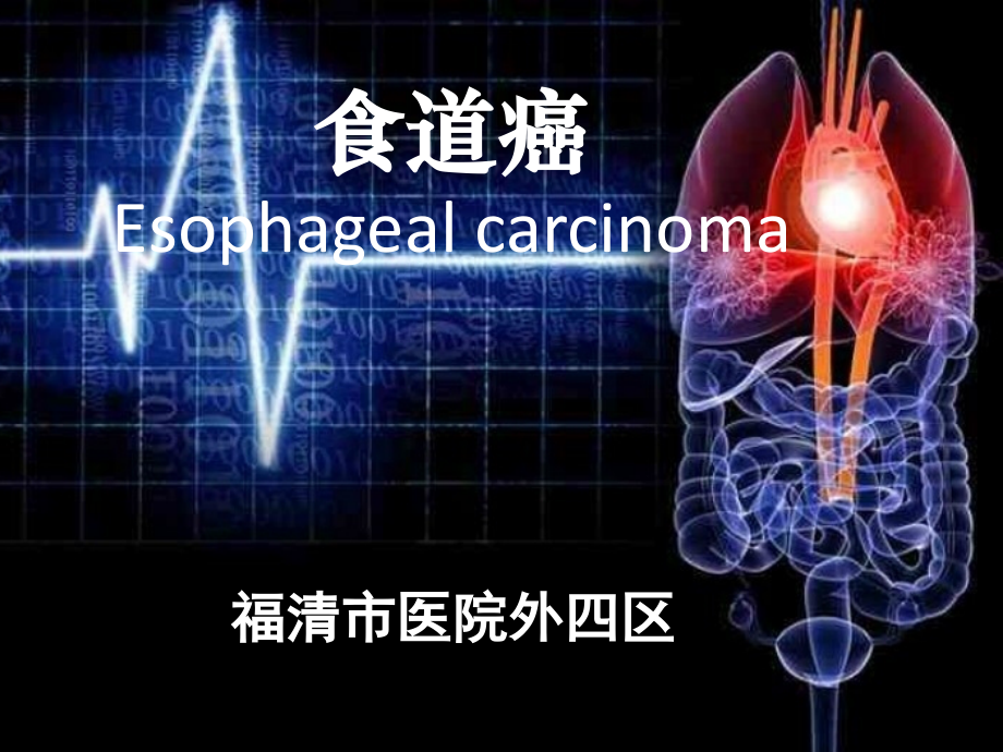 食管癌个案护理查房资料课件_第2页