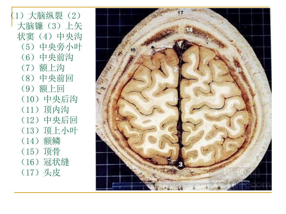 人体断层解剖图谱大脑课件_第4页