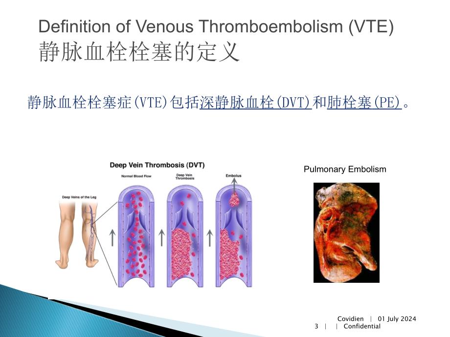 《静脉血栓栓塞》ppt课件_第3页