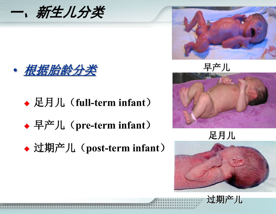 第六章新生儿及新生儿疾病患儿的护理课件_第3页