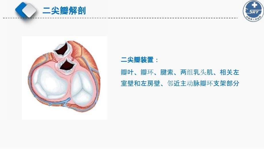 超声心动图在常见心脏疾病评估应用及进展之三--心脏瓣膜病(上)课件_第5页