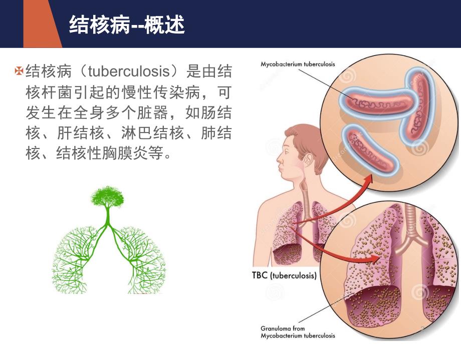 结核病营养治疗ppt课件_第2页