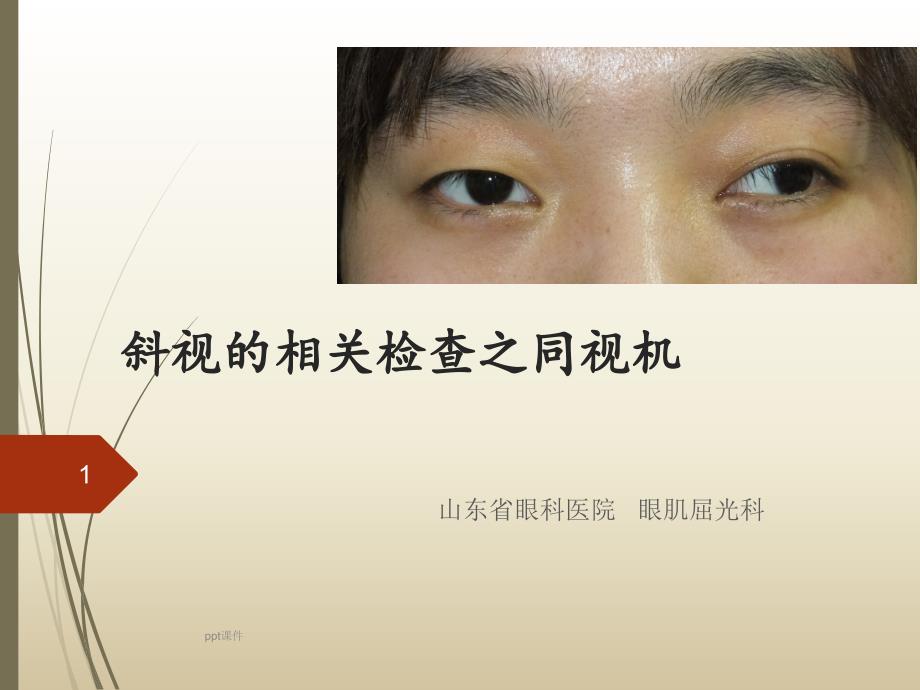 斜视的基本检查同视机课件_第1页