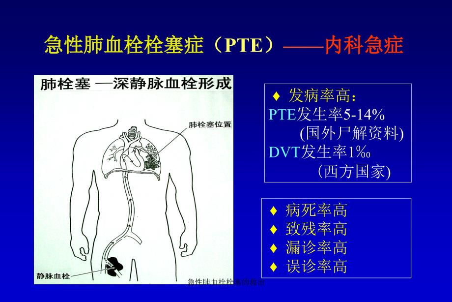 急性肺血栓栓塞的救治课件_第2页