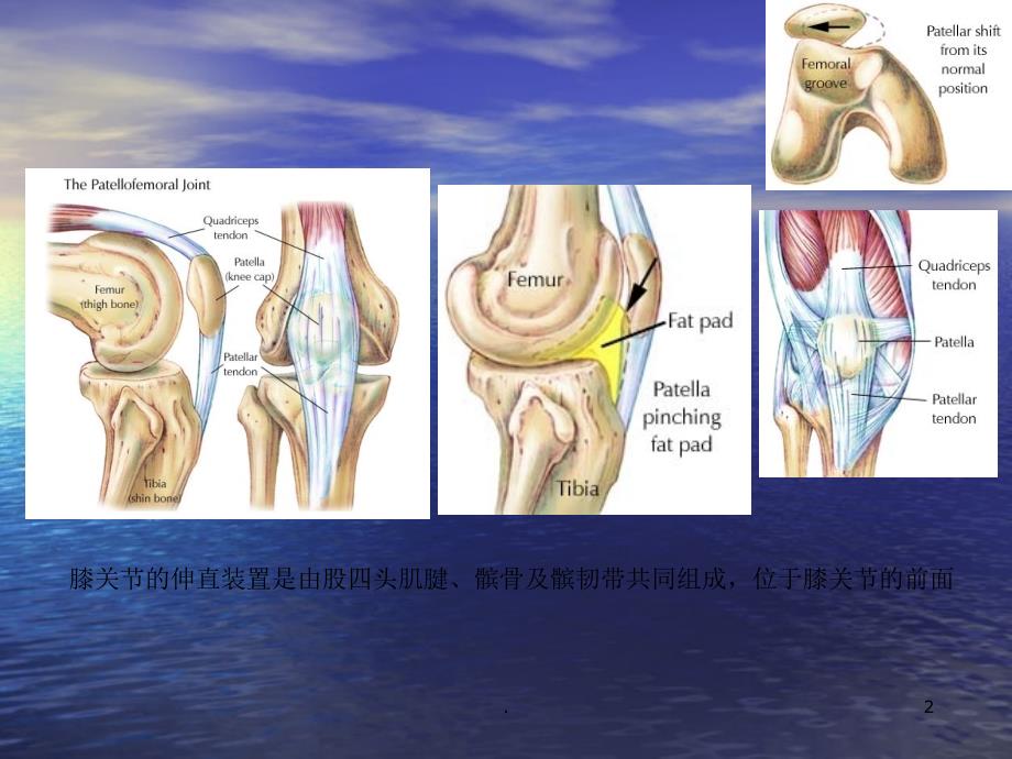 髌骨骨折康复ppt演示课件_第2页