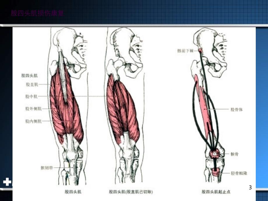 肌肉肌腱损伤康复ppt课件_第3页