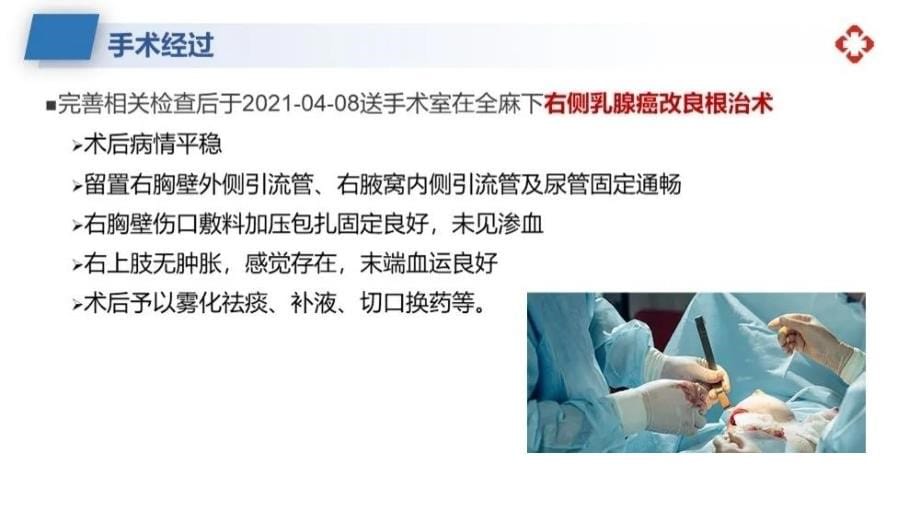 关于乳腺癌根治术后护理查房学习_第5页