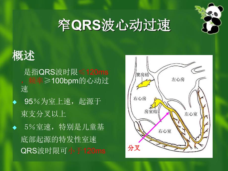 窄qrs波心动过速的诊断与鉴别诊断_第4页