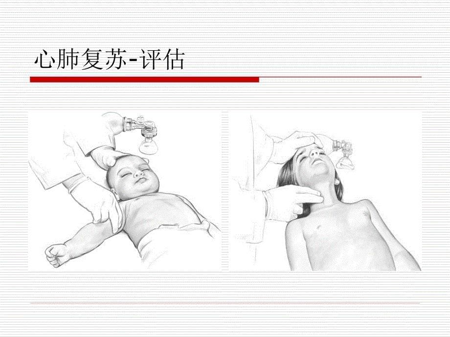 儿童心肺复苏药品基地培训.ppt_第5页