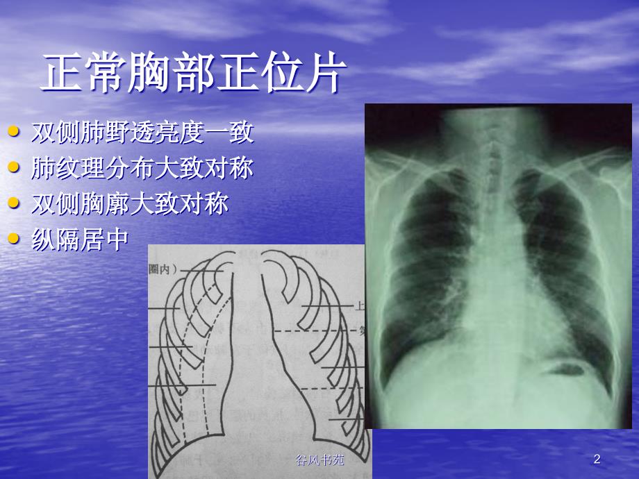 简化记忆X线CTB超执业医师多图技能考试医药荟萃_第2页