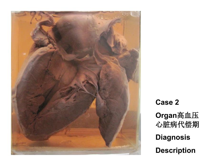 形态学实验II考试 2010(PARTII-B组胚病理)_第2页