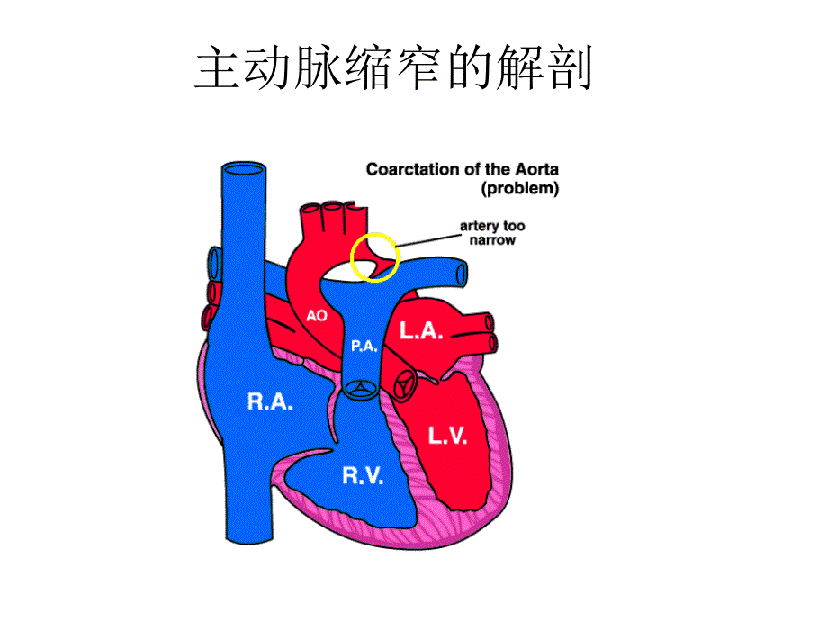 结构性脏病介入器械研制现状_第3页