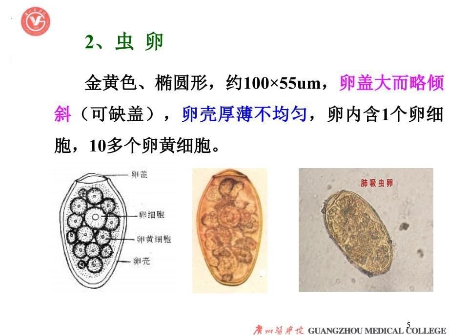 寄生虫肺吸虫PPT优秀课件_第5页