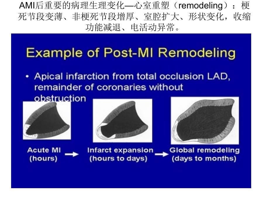 急性胸痛的三件大事ppt课件.ppt_第5页