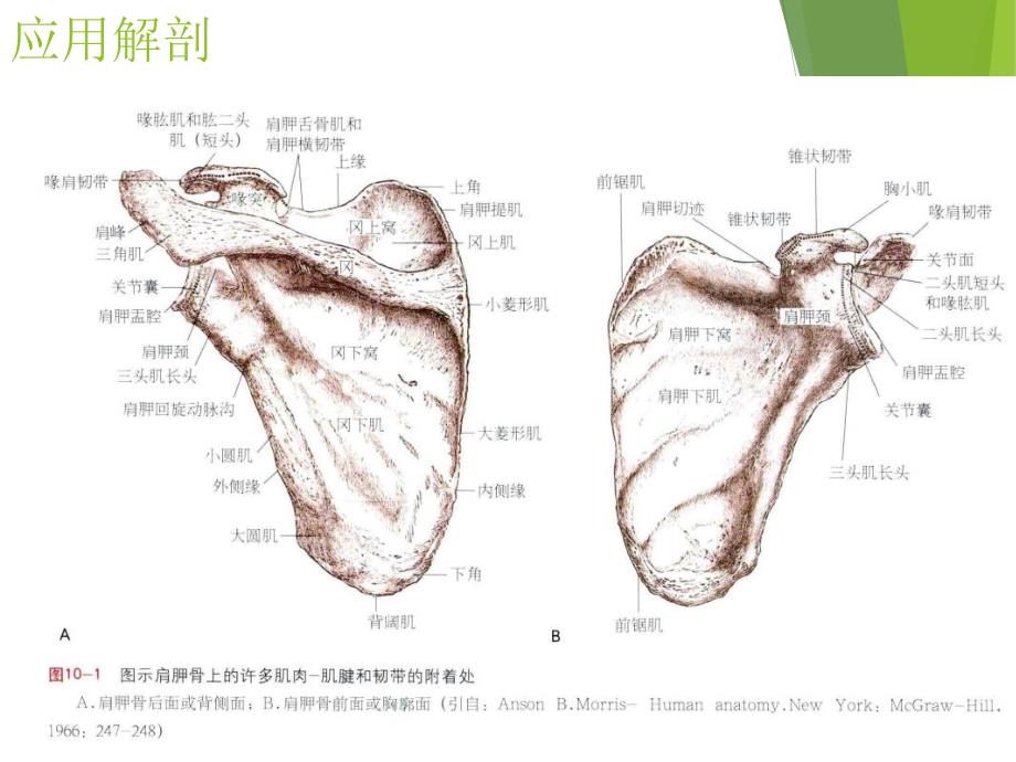 肩胛骨骨折概述_第4页