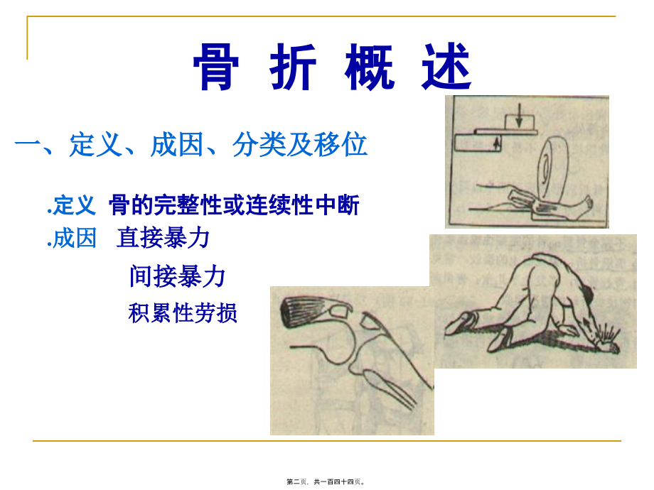 2022医学课件可出现前臂骨筋膜室综合征_第2页