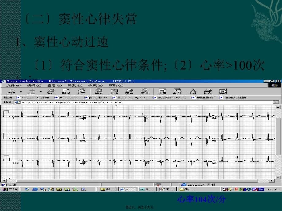 2022医学课件协和医科大学心电图详解_第5页