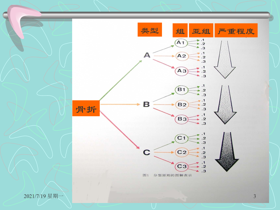 医学专题四肢长管状骨的-AO-综合分类_第3页