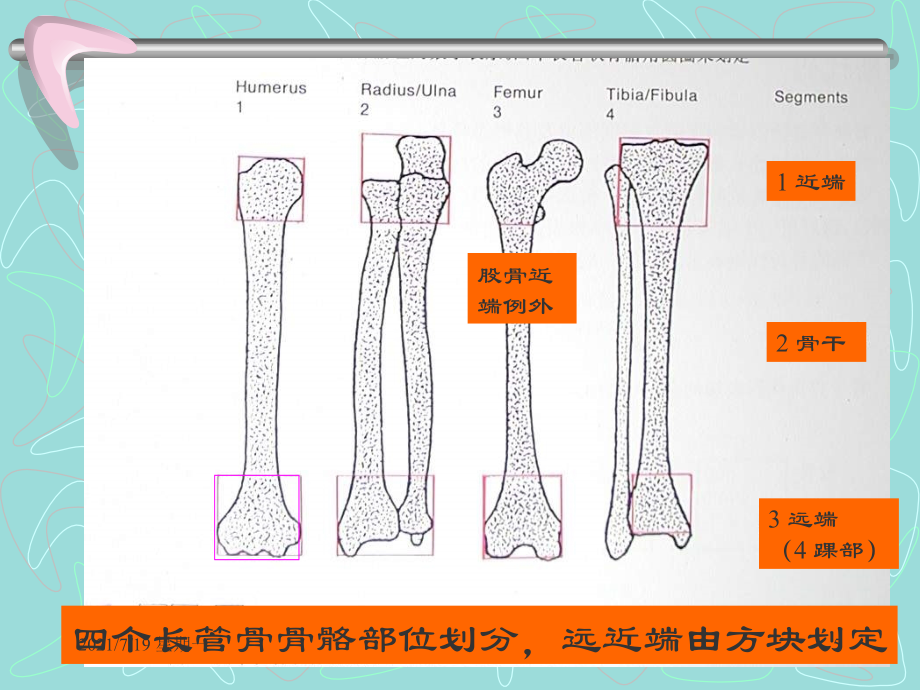 医学专题四肢长管状骨的-AO-综合分类_第5页