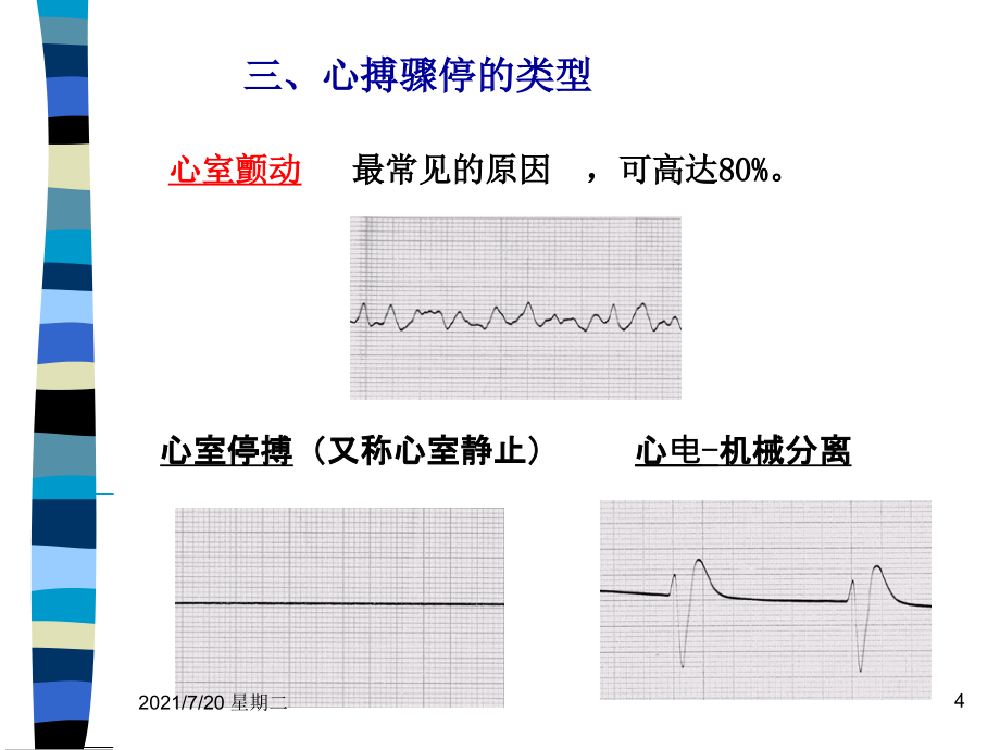 医学专题心肺脑复苏新1_第4页