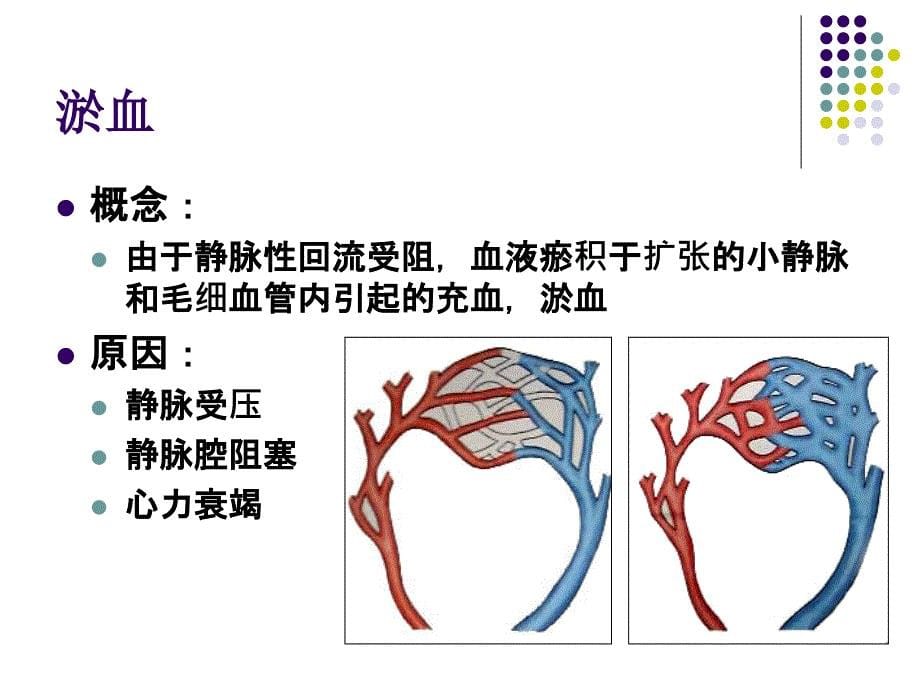 病理学：第四章 血液及体液循环障碍_第5页