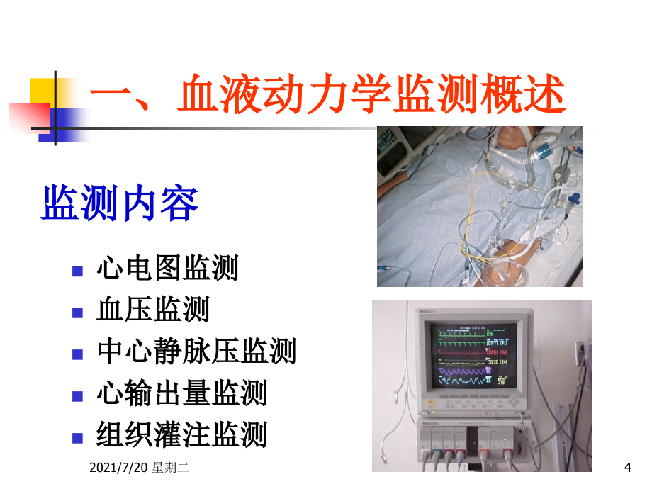 医学专题血液动力学监测新观点4.21幻灯片_第4页