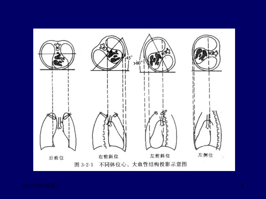 医学专题心脏病幻灯_第3页