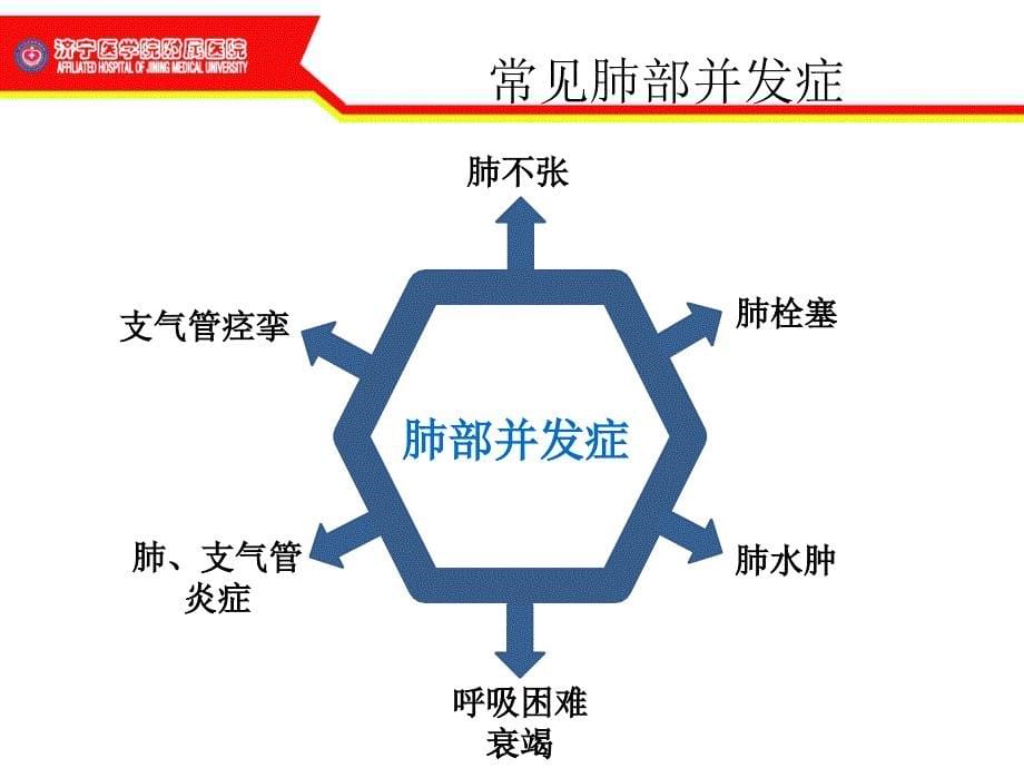 肺扩张与肺复张副本_第5页