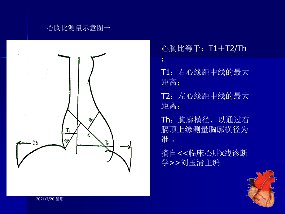 医学专题心脏胸片_第4页