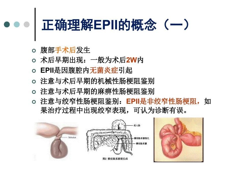 术后早期炎性肠梗阻_第5页