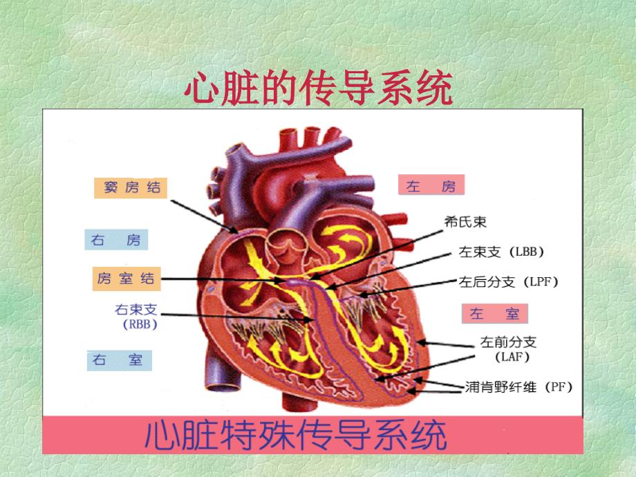 常见异常心电图的识别ppt课件_第3页