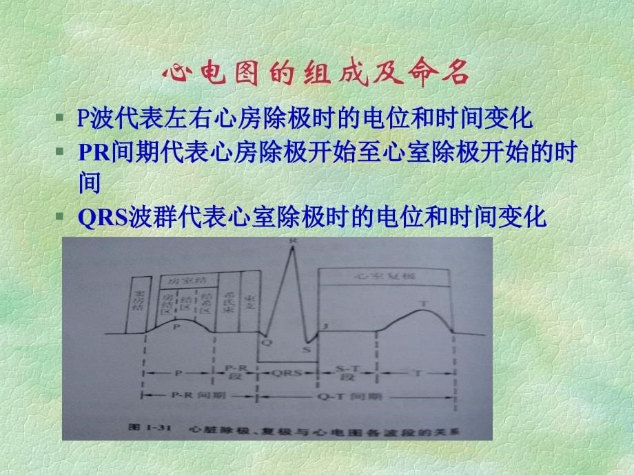 常见异常心电图的识别ppt课件_第5页