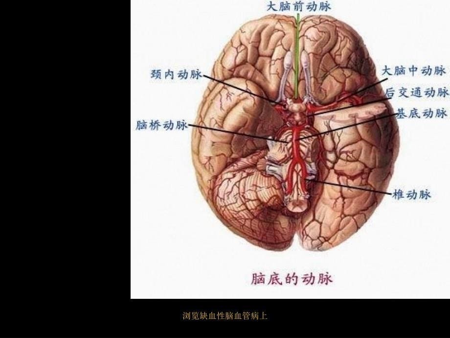 浏览缺血性脑血管病上课件_第5页