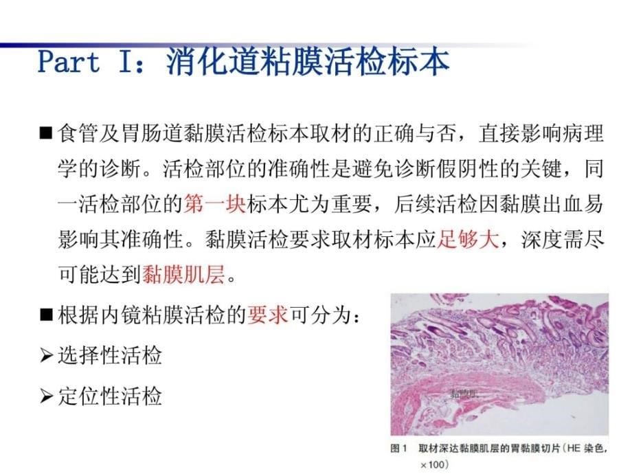 [精彩]消化内镜活组织检查与病理学检查标准专家共叫解读_第5页