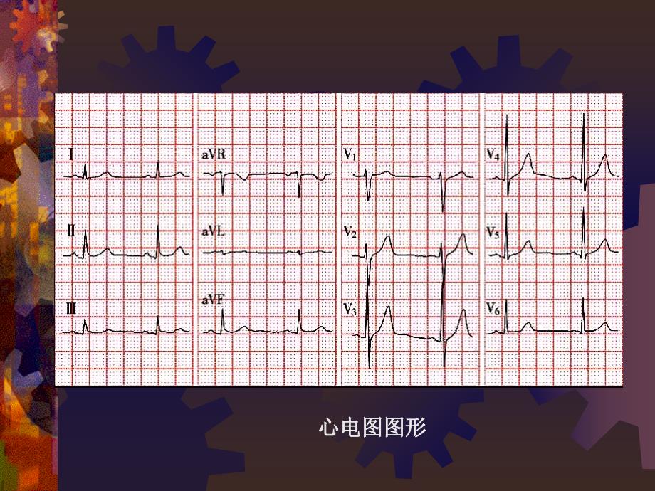 正常心电图ppt课件_第4页