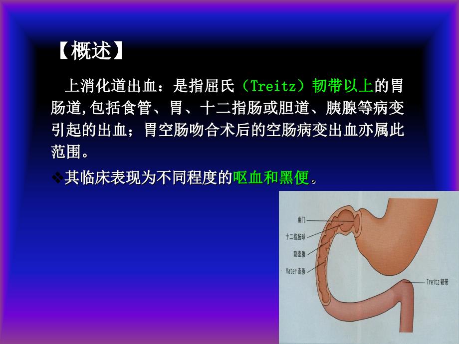 第十一章上消化道出血课件_第3页