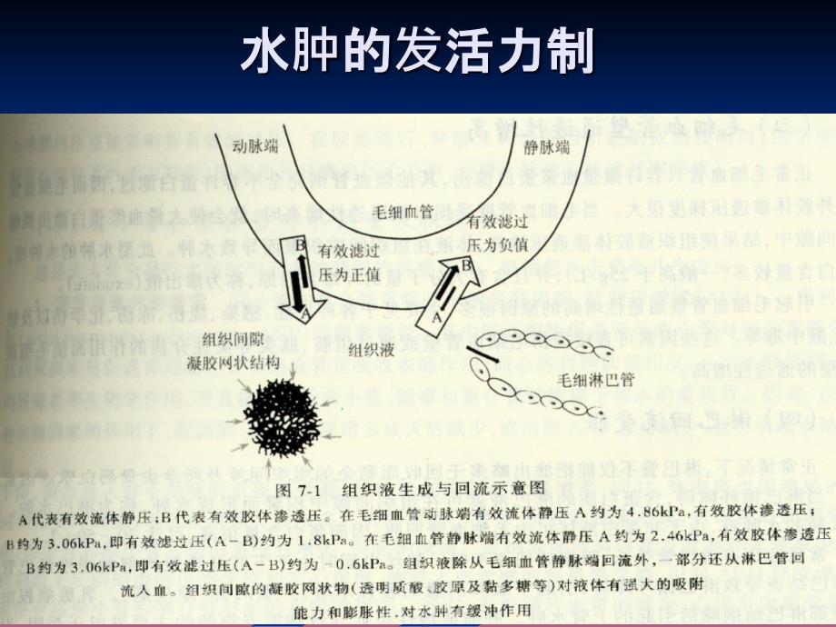 水肿诊断学ppt课件_第3页