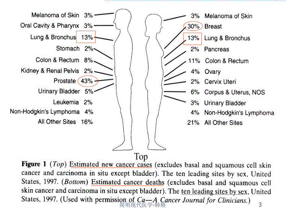 简明现代医学肺癌课件_第3页
