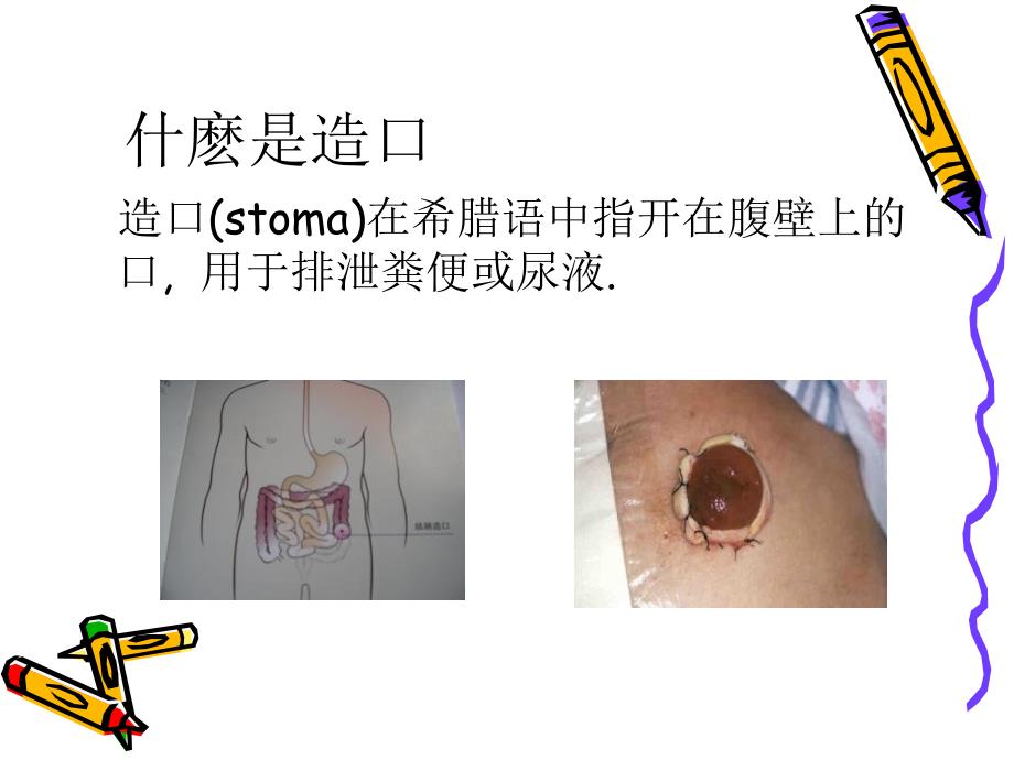 造口护理知识_第2页