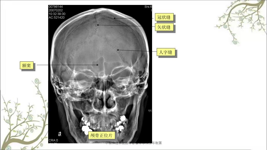 中枢神经系统医学影像学本科五年制第_第2页