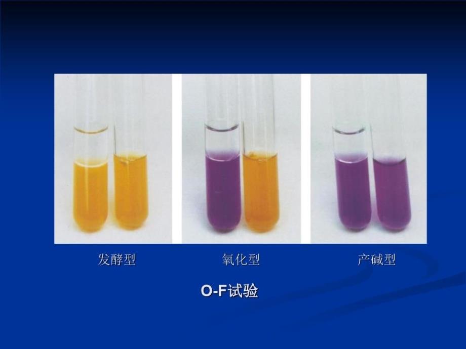 《肠杆菌科细菌》课件.ppt_第4页